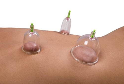 Acupressure India Acupressure India® Plastic Therapy-Cupping Medicine Magnet Pull Out Vacuum Apparatus (White) - Pack of 6