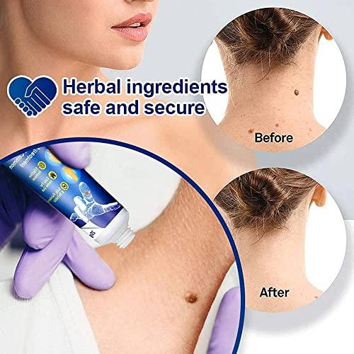 Generic Warts Remover Cream Extract Skin Face Tag Extract Corn Treatment Ointment Painless For Men Women Childrens (Pack of 4 of 100G)