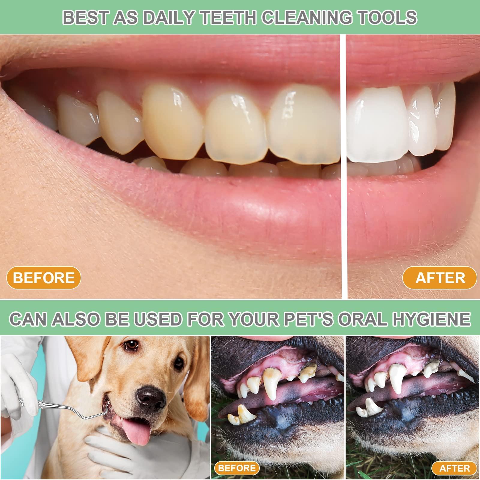 KuanStore Dental Tools, Professional Dental Pick Tools Kit, Teeth Cleaning Calculus Tool for Dentist, Personal Using, Pets Oral Care with Dental Mirror Dental Tooth Tartar Plaque Scraper Remover Dental Probe