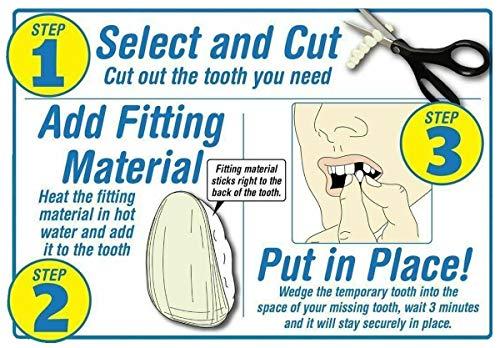 Instant Smile Instant Smile Select A Tooth Temporary Tooth Replacement Kit- Combo