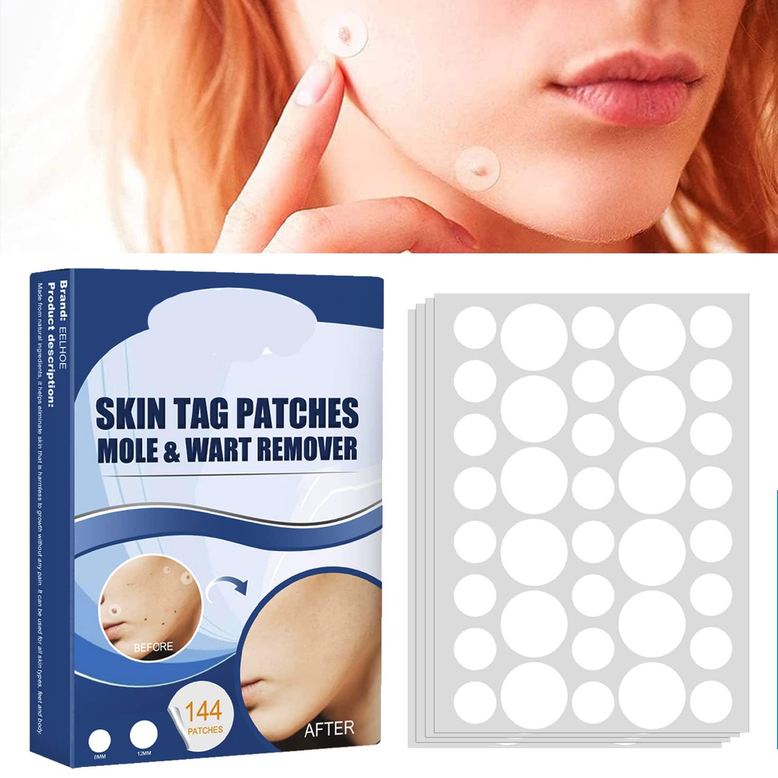 ATORSE ATORSE Wart Stickers 144 Patches Wart-Removing Sticker Corn Removal Patches, Safe and Gentle on Skin, Wart Removal for Face, Hands, Feet, and Body, Fast-Acting Non-Irritating