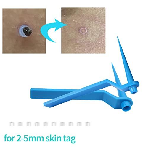QUKAN QUKAN 2 in 1 Skin Tag Remover Set Skin Tag Removal Kit with Rubber Bands Rings for Removing Small to Medium (2mm to 8mm) Sized Skin Tags Painlessly