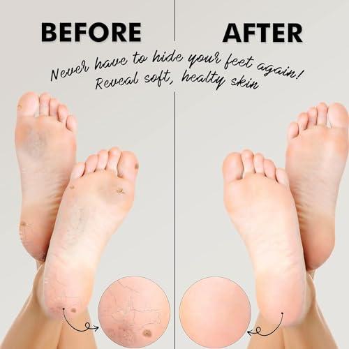 AMPLE FOODS Amples Jowar suji/ravva | Jonna ravva |Healthy Breakfast | No preservatives added | 500 gms | Gluten free