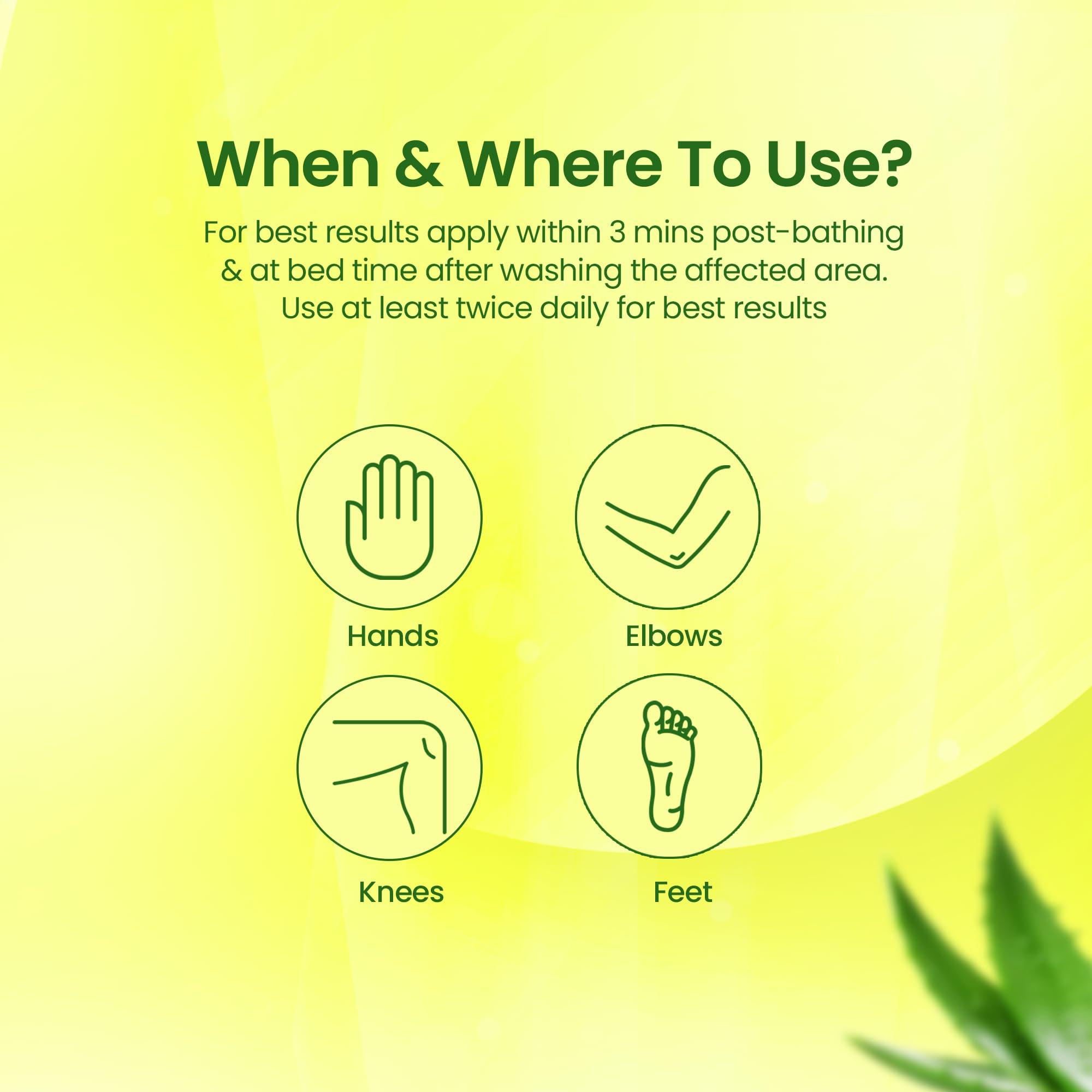 NMFe UREA CREAM NMFe Urea Cream 150 gm For Intense Moisturisation with Urea 7% & Aloe vera for thick and dry skin | Truly the Healing Moisturiser | For very dry skin | Takes care of cracked heels & Fissure feet effectively