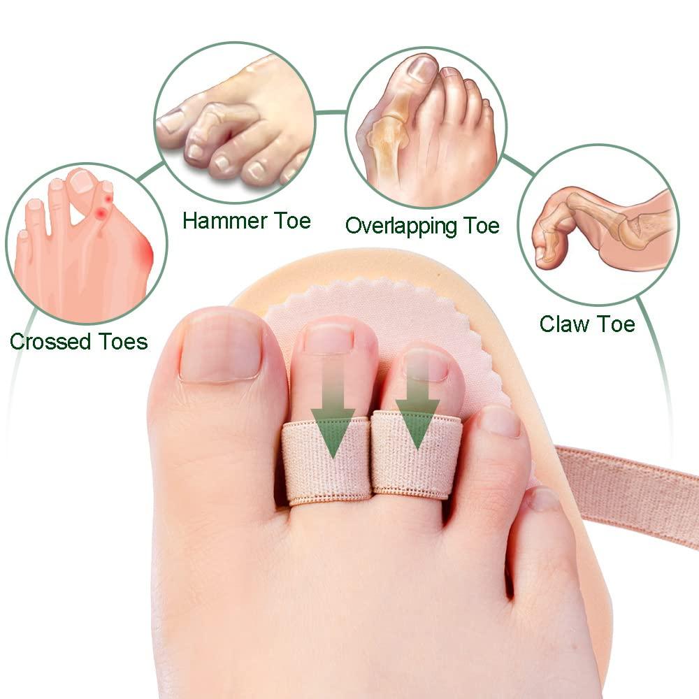 Welnove 2 Hole Toe Straightener *2: Welnove - Toe Straightener Hammer Toes Hammer Toe Correctorfor Claw Toe Mallet Toe Contracted Toe and Cured Toe Pack of 2(2 holes)(Hammer Toe Straightener)