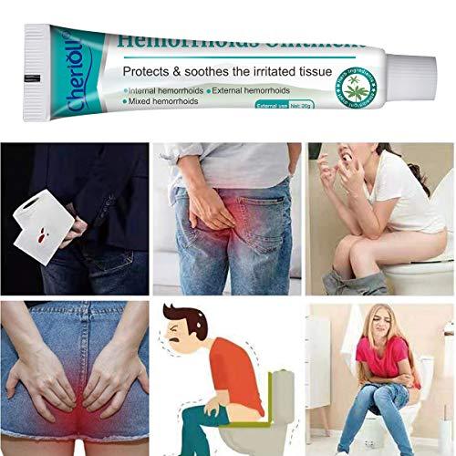 Cherioll Cherioll Hemorrhoid Cream, Haemorrhoids Treatment, Hemorrhoid Relief,for Hemorrhoids Fissures Bleeding, 20g2 (Assistant tub 4Pcs)
