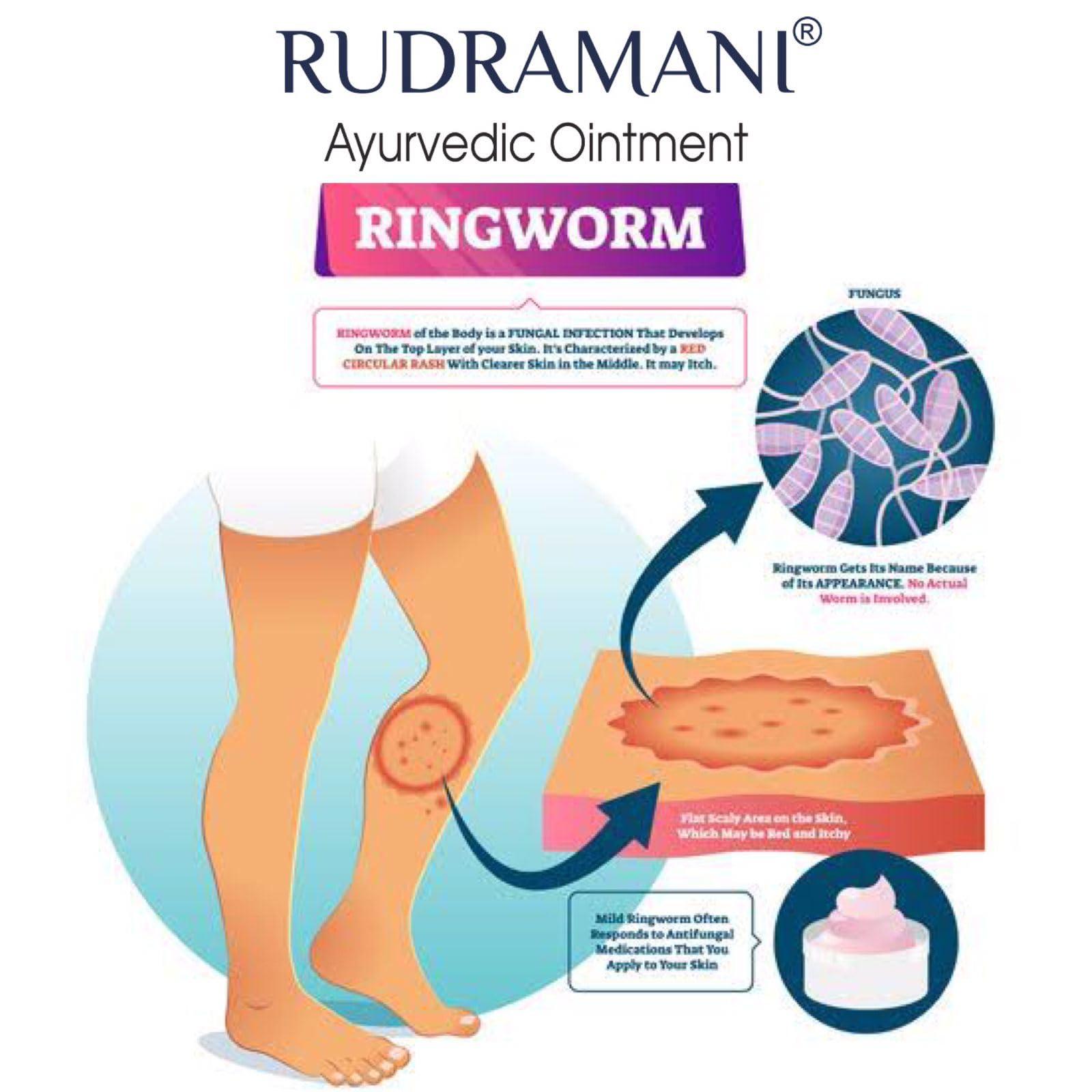 Generic Rudramani Marham Malam Dad Khaj Khujli fungal Ointment - for Ringworm, itching & Skin Infection, Skin Tretment, Skin Care. (25GRAM)