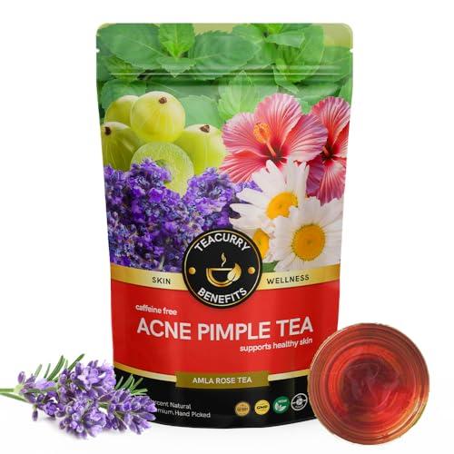 TEACURRY TEACURRY Acne & Pimple Care Tea - 15 Tea Bags | Helps Reduce Pimple Breakouts, Acne Marks | Pimple Acne Tea, Spearmint, 50 Gm