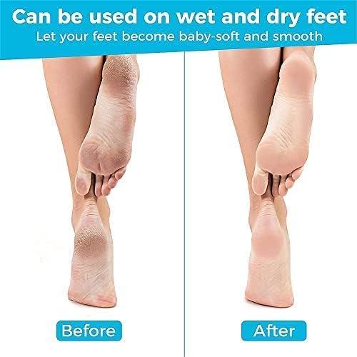 GLOW FIRST GLOW FIRST Leg, Heel & Foot Scrubber for Dead Skin - Very Sharp & Big (11 * 3 inch) - Pedicure & Feet Scrub Tools, Foot Scraper Cleaner & Filer, Callus Remover For Cracked Heels (Metal)