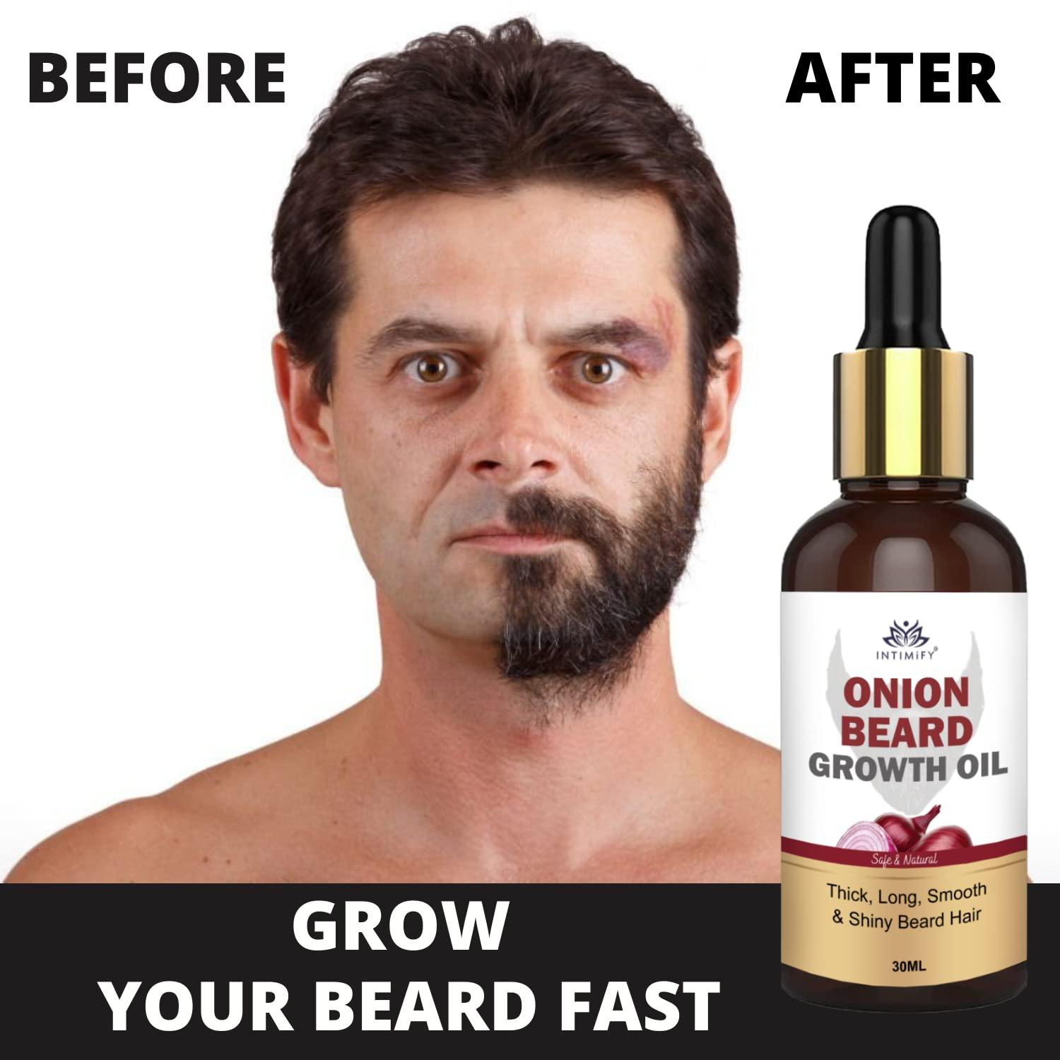INTIMIFY INTIMIFY Onion Beard Growth Oil | Dadhi Badhane Wala Oil | Beard Oil for Patchy And Uneven Beard | Mustache Growth Oil For Men With Jajoba Oil (30 ml - Pack of 1)