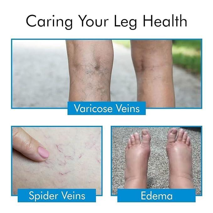 SGS Surgical VERICOSE VEINS STOCKINGS SOCKS | Leg Compression Varicose Vein Stockings For Swollen, Aching Legs, Pain Relief Stockings, Edema, Sore Legs, Men & Women (S)