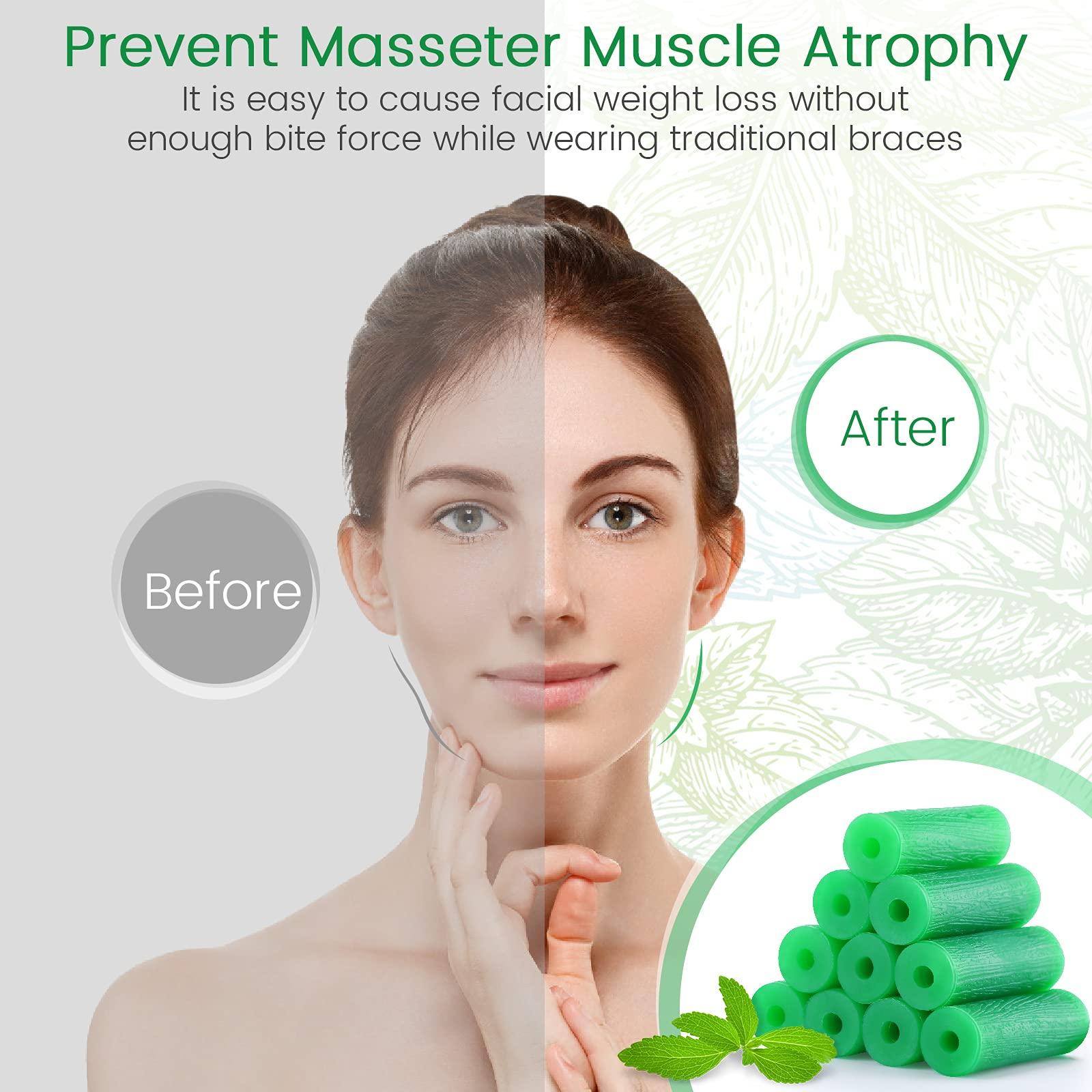 melonsun Aligner Chewies for Invisalign Aligners Mint Scented (20 Pcs Green) and Aligner Removal Tool (2 Pcs Pink)