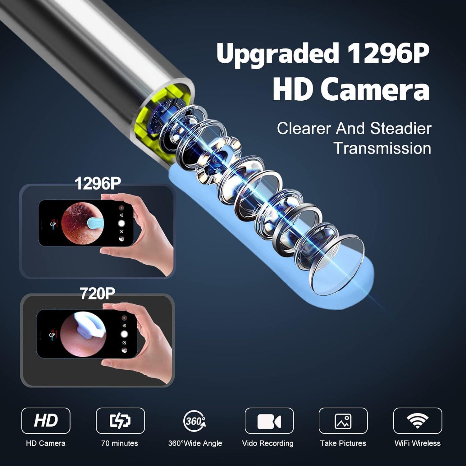 NOVUSOL NOVUSOL Ear Wax Removal Tool Kit, 9 Pcs Ear Otoscope Camera Wireless 1296P HD 3.5mm Ear Wax Cleaner with 6 Led Light 350mAh Ear Camera for iOS & Android, Black 1 Year Warranty