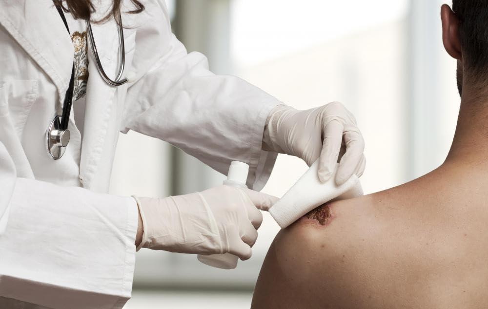 NUVO MEDSURG NUVO MEDSURG Non Sterile Cotton Gauze Dressing Pad - 30 Cm x 10 Cm - 10 Pads