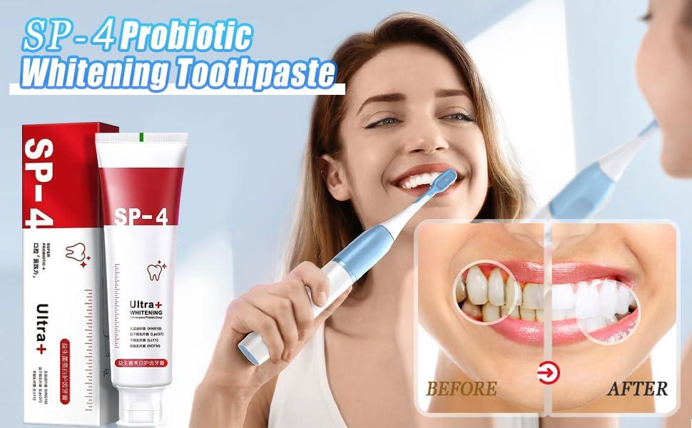 LACASA BEAUTY CARE SP-4 Probiotics Whitening Toothpaste, Sp-4 Probiotic Toothpaste, Yayashi SP-4 Probiotics Whitening Toothpaste, Teeth Whitener Toothpaste (1pcs)