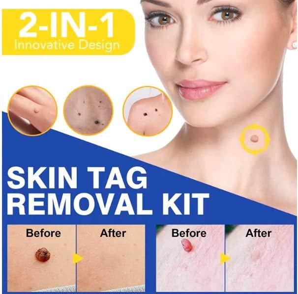 Generic Auto Skin Tag Remover Kit, Skin Tag Removal Patch, Skin Tag Remover Kit 2 in 1 Skin Tag Removal