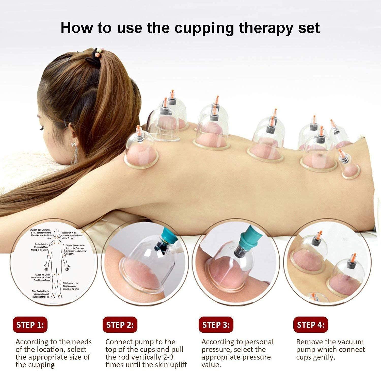 Generic Hijama 12 Cupping Cups Bio Magnetic Traditional Chinese Therapy Cupping Set Household Pull Out Vacuum Cupping Kit/Chinese Massage Medical Cupping Set Suction Acupuncture with Extension Tube