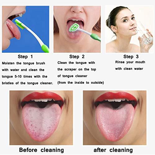 MR LION Tongue Brush, Tongue Scraper, Tongue Cleaner Helps Fight Bad Breath, 2 Tongue Scrapers, 2 Pack (Blue & Orange)