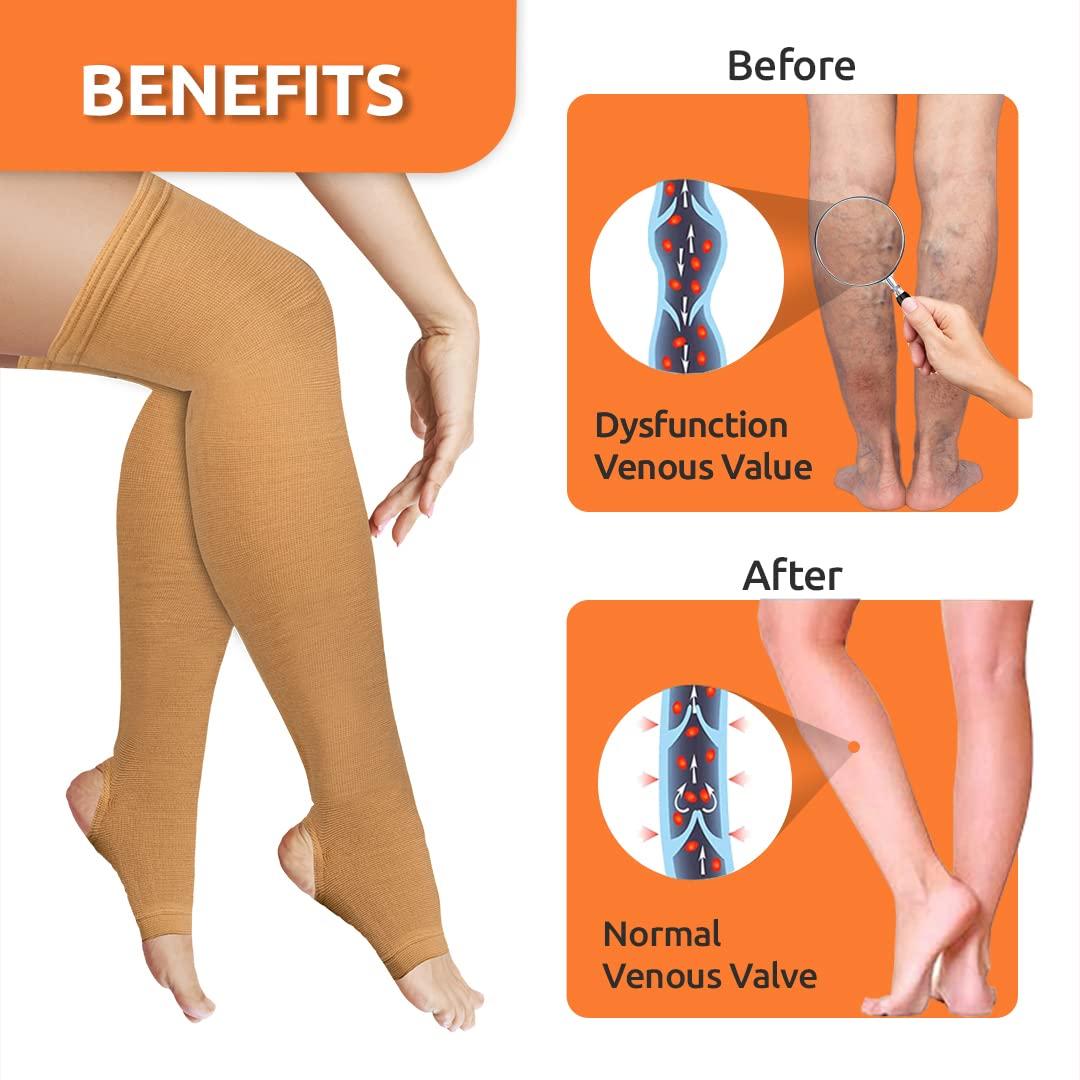 Vissco Vissco Varicose Vein Stockings, Thigh Length (Above Knee), Stockings for Swollen, Tired, Aching Legs, Pain Relief, Edema, Sore Legs for Women- Small (Beige) - 1 Pair