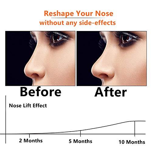 Lenlorry Nose Shaper Clip Nose Lifter Nose Beauty Up Lifting Tool Soft Safety Silicone Rhinoplasty Nose Bridge Straightener Corrector Slimming Device for Wide Crooked Nose Women (Pink)
