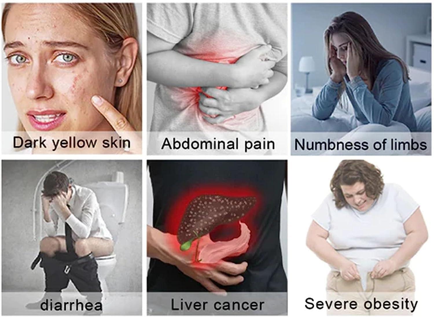 3nh 3NH Milk Thistle & Cordyceps Sinensis Drops,Milk Thistle & Cordyceps Extract Herbal Drop,Cordyceps Sinensis Drops, Powerful Liver Support (2PCS)