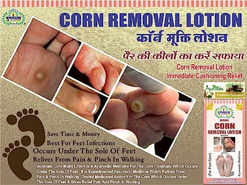 GUNMALA Herbal Foot Corn Lotion, For Remove Feet Fast And Relives From Pain & Pinch In Walking Best For Feet Infections, 5 Ml. Bottel Pack,Qty.-Pack Of 2