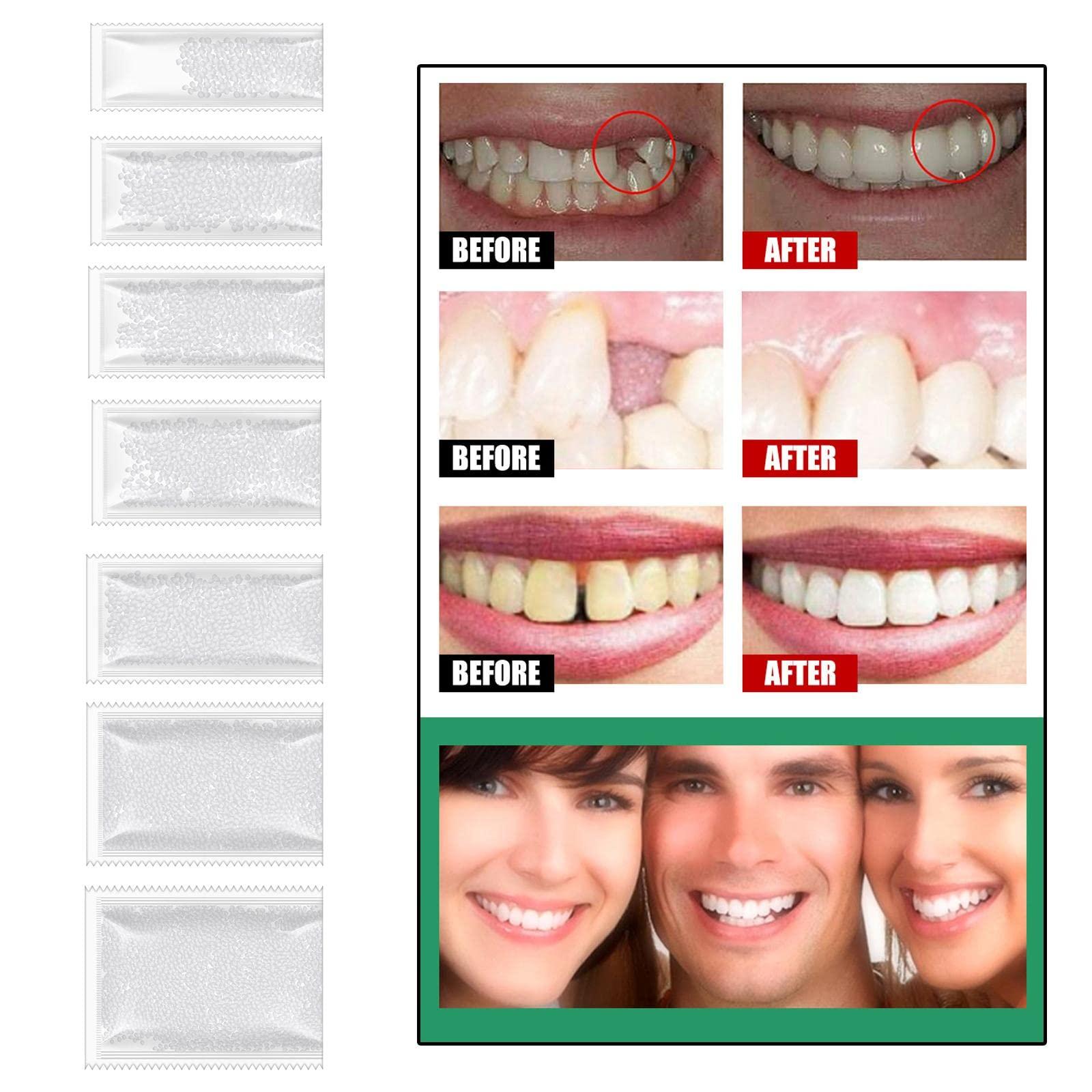 ATORSE ATORSE DIY Tooth Filling Thermal Beads Temporary Teeth Repair Moldable 5g