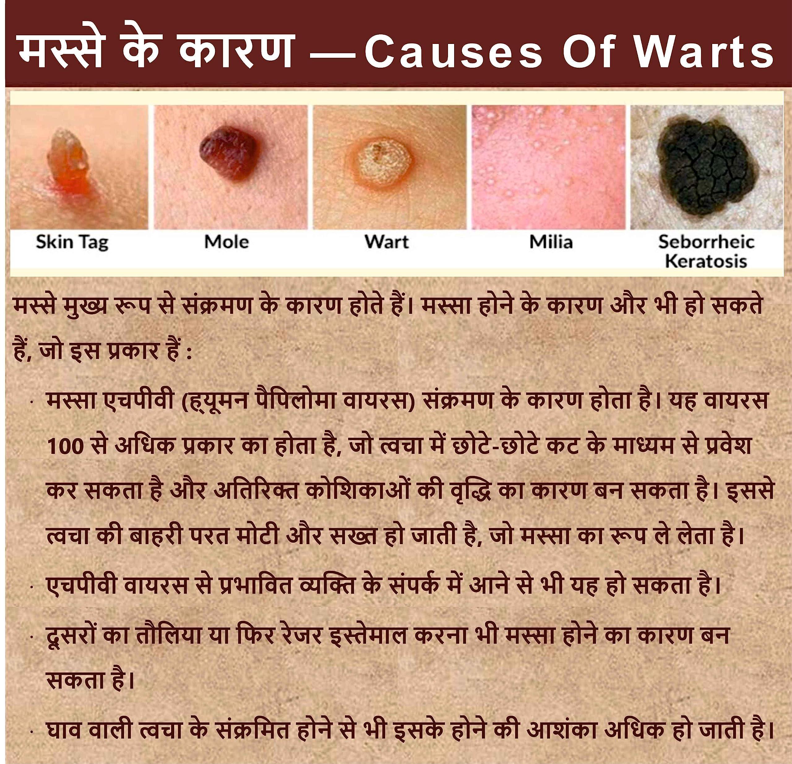 Gunmala Herbals Gunmala Herbal Massa Mukti Lotion - 20 Ml. (Ayurvedic Skin Tag Remover)