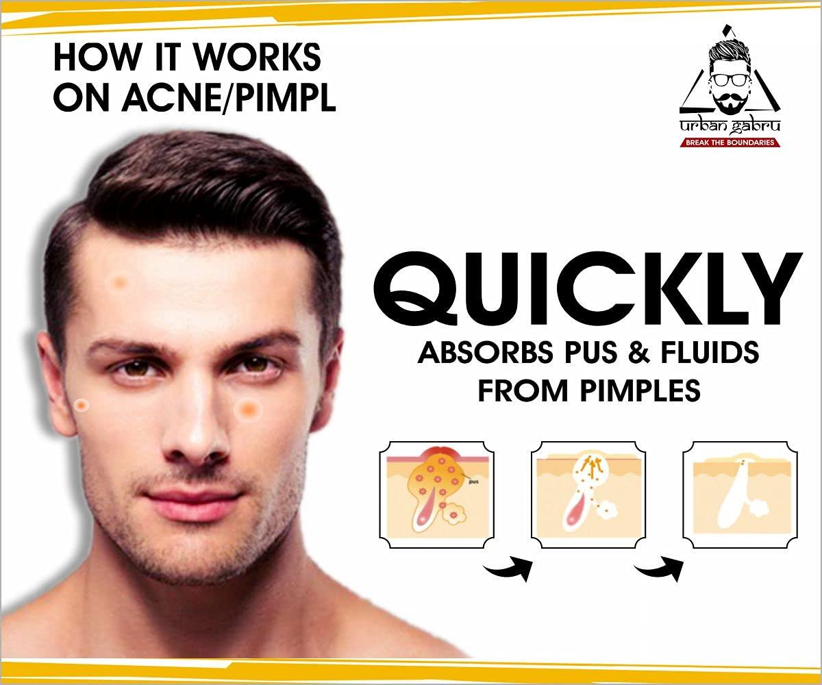 urbangabru urbangabru Men Hair Removal Cream Spray (200 Ml) + Acne Pimple Patch (72 Dots) - Body And Face Care Combo Kit, Pack of 1