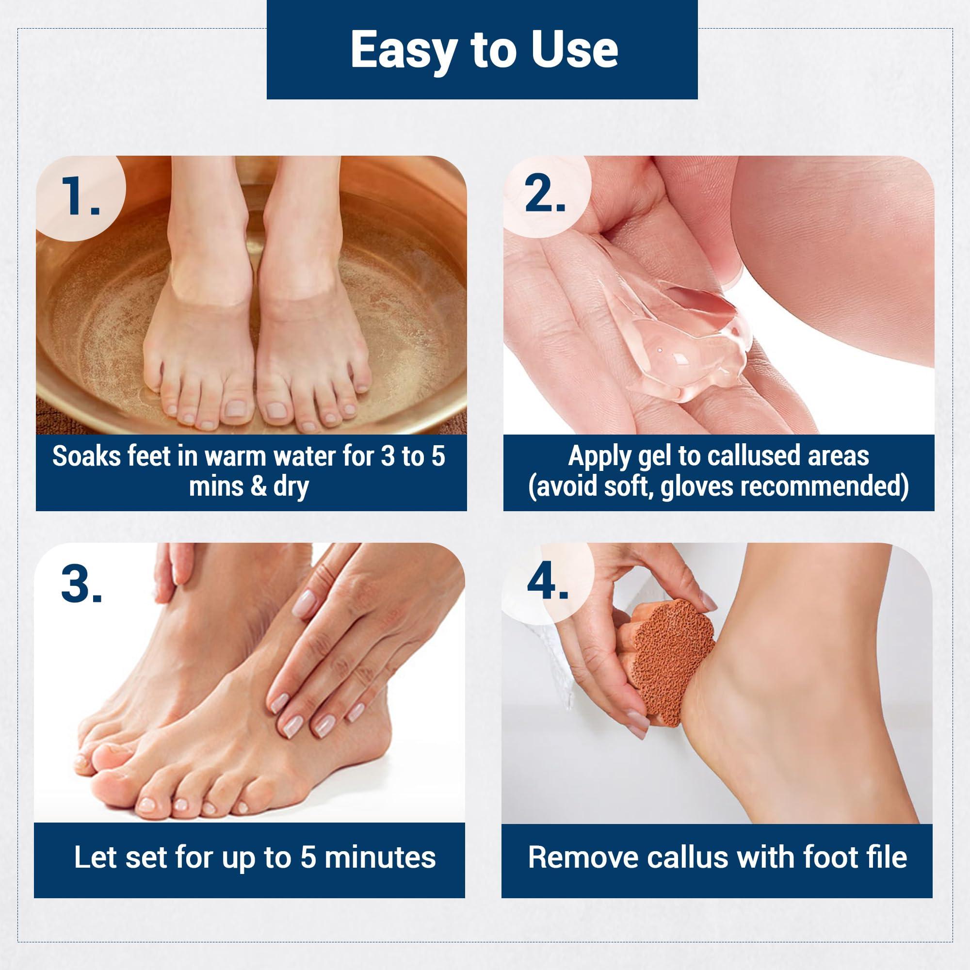 Dr Foot Dr Foot | Callus Remover for Feet | Callus Remover Gel | Feet Dead Skin Remover | Foot Cream for Cracked Heels | Foot Cleaner for Dead Skin | With Urea, Coconut Oil & Aloe Vera | For Men & Women