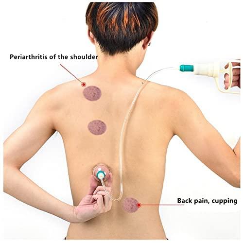 4beauty Therapy 4beauty Therapy Vaccum Cupping Therapy Set - Chinese Traditional Healthy Body Vacuum Acupuncture Cupping for Cellulite Cupping Massage (SET OF 12)