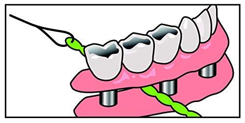 iDontix Idontix X-Floss 30 Strands Easy Bridge And Implant Floss by Idontix