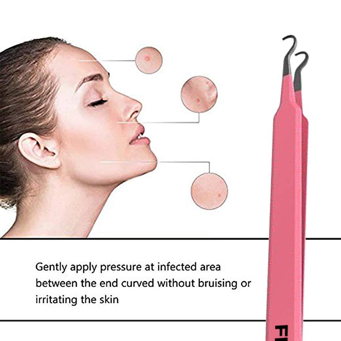 FEITA Blackhead Acne Extraction Tweezers - FEITA Pro & Surgical-Grade Stainless Steel Bend Curved Comedone Extractor Tweezer Tool for Remove Whitehead and Clogged Pores, Pimple - Pink