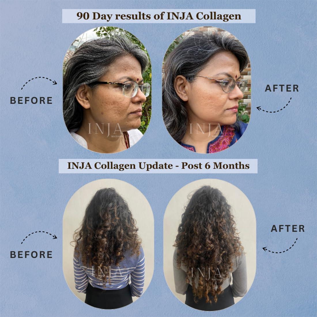 INJA Wellness INJA Wellness Life Marine Collagen Supplement Powder for Women & Men, Japanese Collagen with Original Formulation, Healthy Skin, Joints, Hair Growth, Zero Sugar, Blueberry Flavor, 150 gm