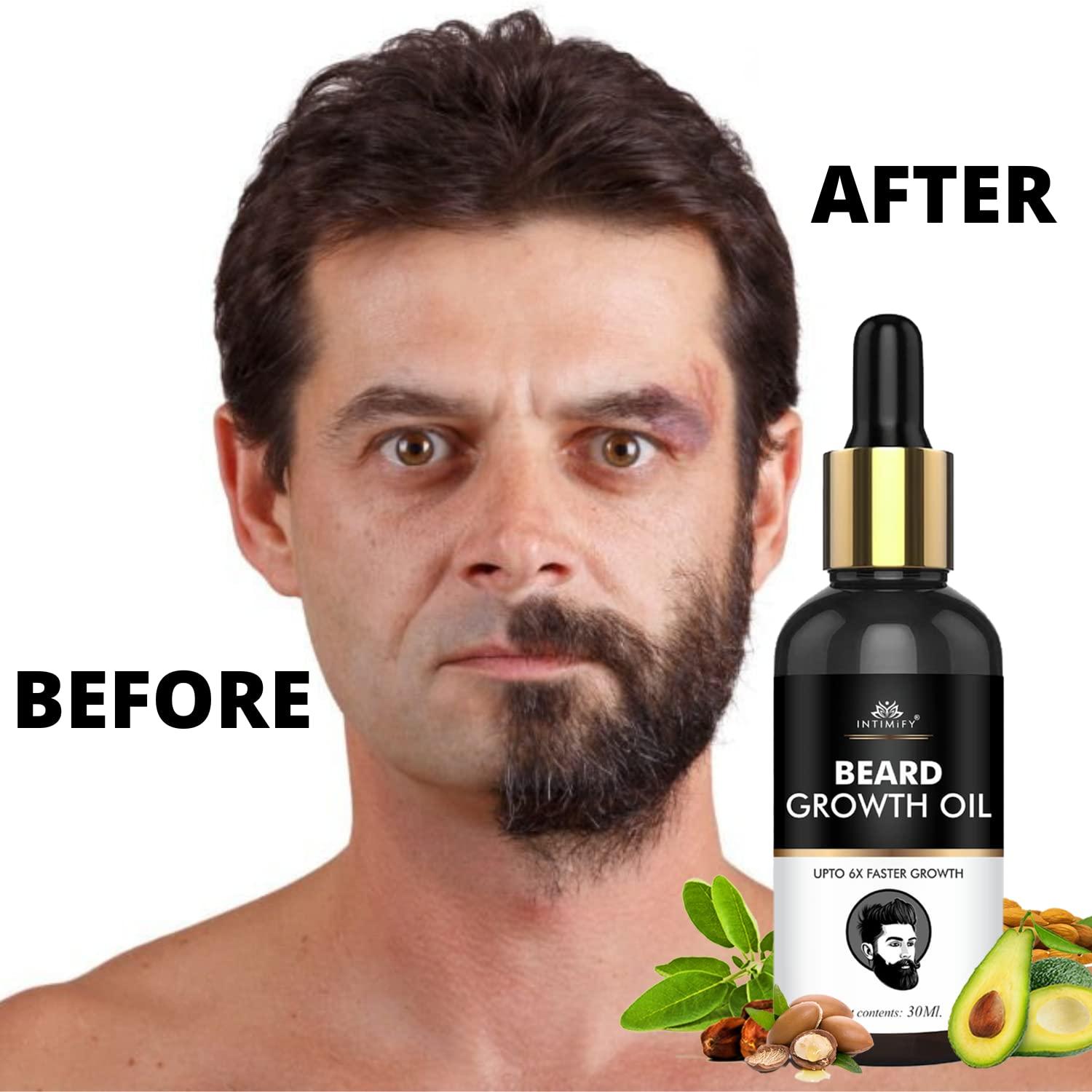 INTIMIFY Beard Oil For Growing Beard Faster, Mustache Beard Growth Oil, Beard Oil For Men Fast Growth, Beard Oil For Pachy Beard, Beard Oil For Smooth Beard