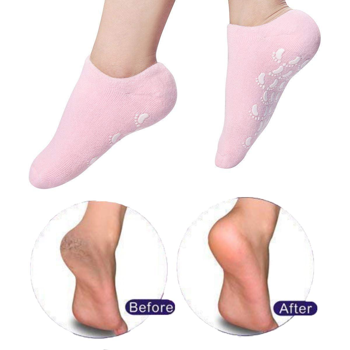 GOLDINKS GOLDINKS moisturising spa gel socks (gel inside) For Dry Hard Cracked Heels Repair, reduces cracked heels, washable & reusable Foot Protector Pain Relief Foot Care Support one size fits all