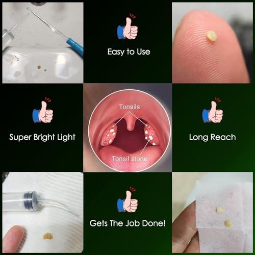 airgoesin Airgoesin Lighted Tonsil Stone Remover Tools or Earwax Removal Tools, Yellow, 3 Tips, Tonsillolith Pick Case + 1 Irrigator Cleaner : Yellow