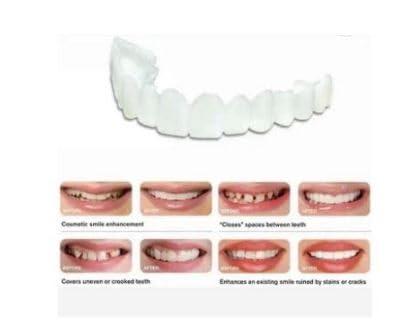 Zemiss Snap On Teeth Veneers Nonporous Dentures For Men Women Cover The Teeth Instant Confident Smile Temporary Teeth