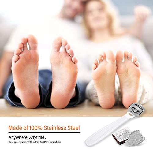 Mudder 24 Pieces in Total, 2 Callus Shaver Sets Include 20 Replacement Slices 2 Callus Shavers and 2 Foot File Heads Foot Care Tools Hard Skin Remover for Hand Feet (White)