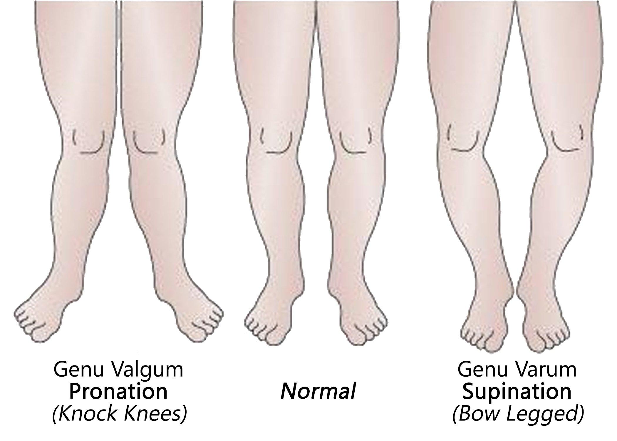 Laminet Cover Co. Posture Corrective Heel Cups W8.5-11/M7-13