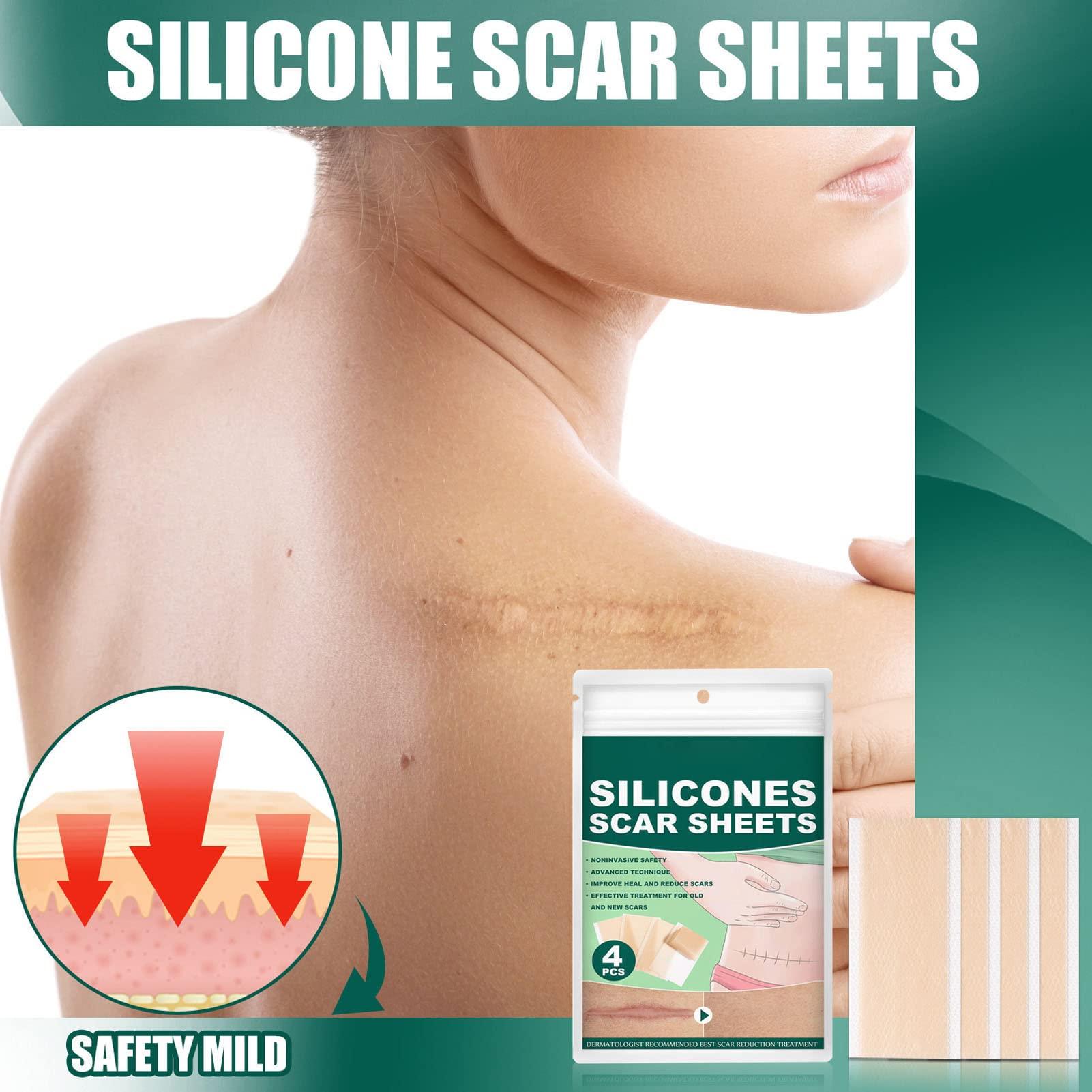 Folanda 4 Pcs Silicone Scar Sheets, Ultra Thin Breathable Silicone Gel Scar Tape, Soften and Flattens Scar Removal Strips for C-Section, Surgery, Burn and More, Skin Scar Concealing Tape