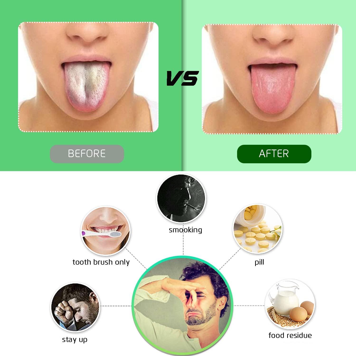 Calitate24 Calitate24 6Pcs Tongue Cleaner Brush,Abs Flexible Tounge Scraper Cleaner,Brushing And Scraping For Oral Care,Double Sided Tongue Cleaning Brush,Multicolor