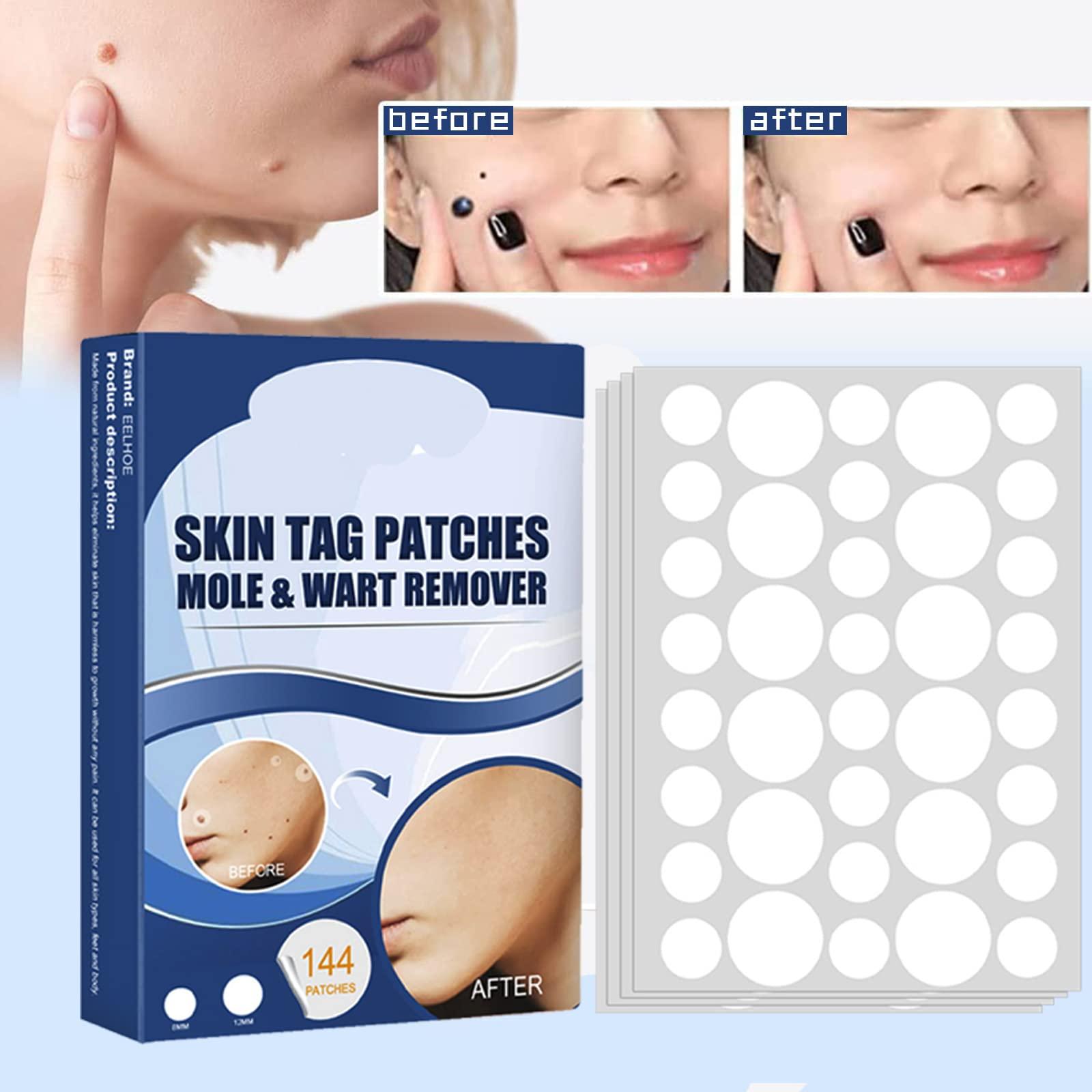 ATORSE ATORSE Wart Stickers 144 Patches Wart-Removing Sticker Corn Removal Patches, Safe and Gentle on Skin, Wart Removal for Face, Hands, Feet, and Body, Fast-Acting Non-Irritating