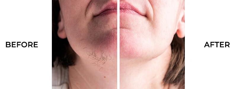 NATURAL HEALTH AND HERBAL PRODUCTS Natural Herbal & Herbal Products Magic Wax Powder instant Hair Removal wax powder for All Types of Hair & Skin, Hands, Legs, Underarms, Bikini (Private Part) Area (Unisex adult) 10 Mintus - 100g