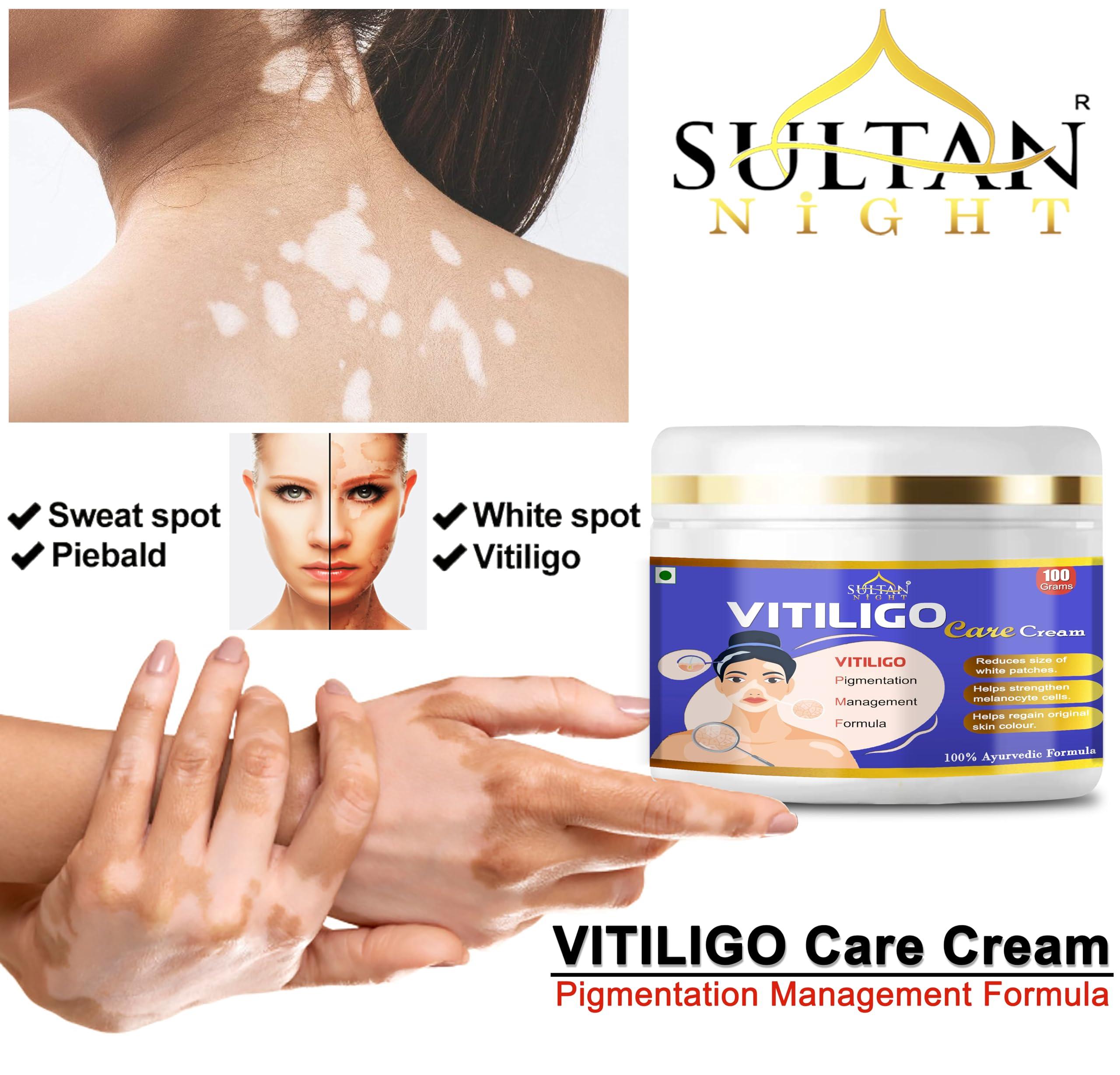 Sultan Night Sultan Night Vitiligo cream 100gm | Super Effective on Vitiligo | White Patches, Discoloration of Skin, Scar Removal, Piebald, Sweat Spot for men and women(2x50g)