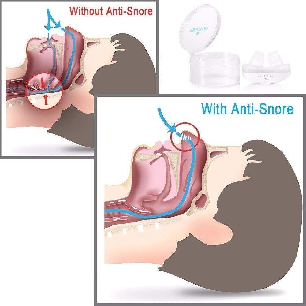 BRAHMVILLA BRAHMVILLA 2 in 1 Anti Snoring and Air Purifier Nose Breathing Apparatus Clip Device for Comfortable Night Sleeping
