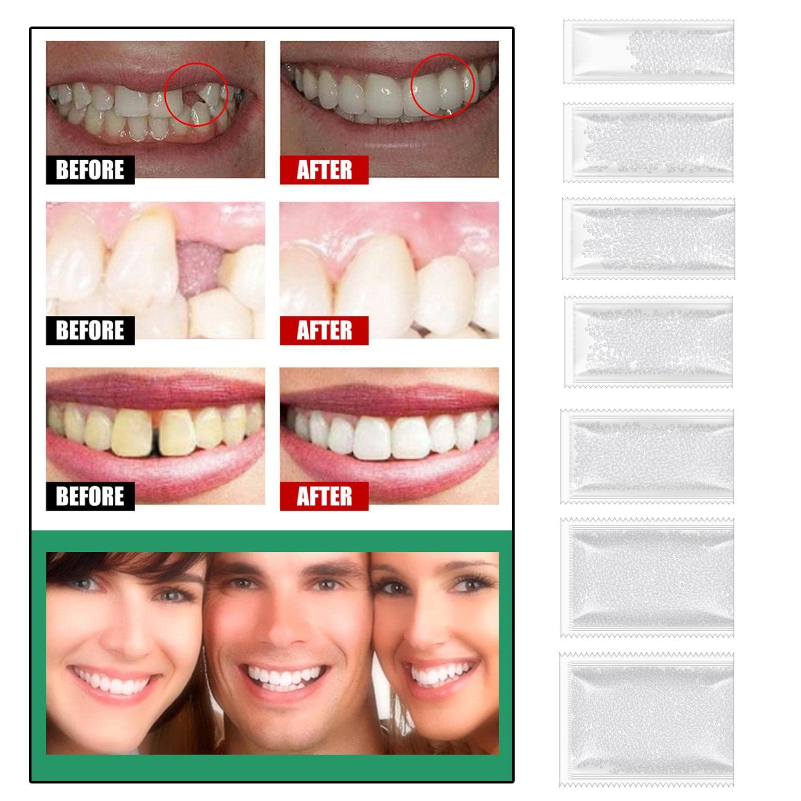 ATORSE ATORSE DIY Tooth Filling Thermal Beads Temporary Teeth Repair Moldable 5g