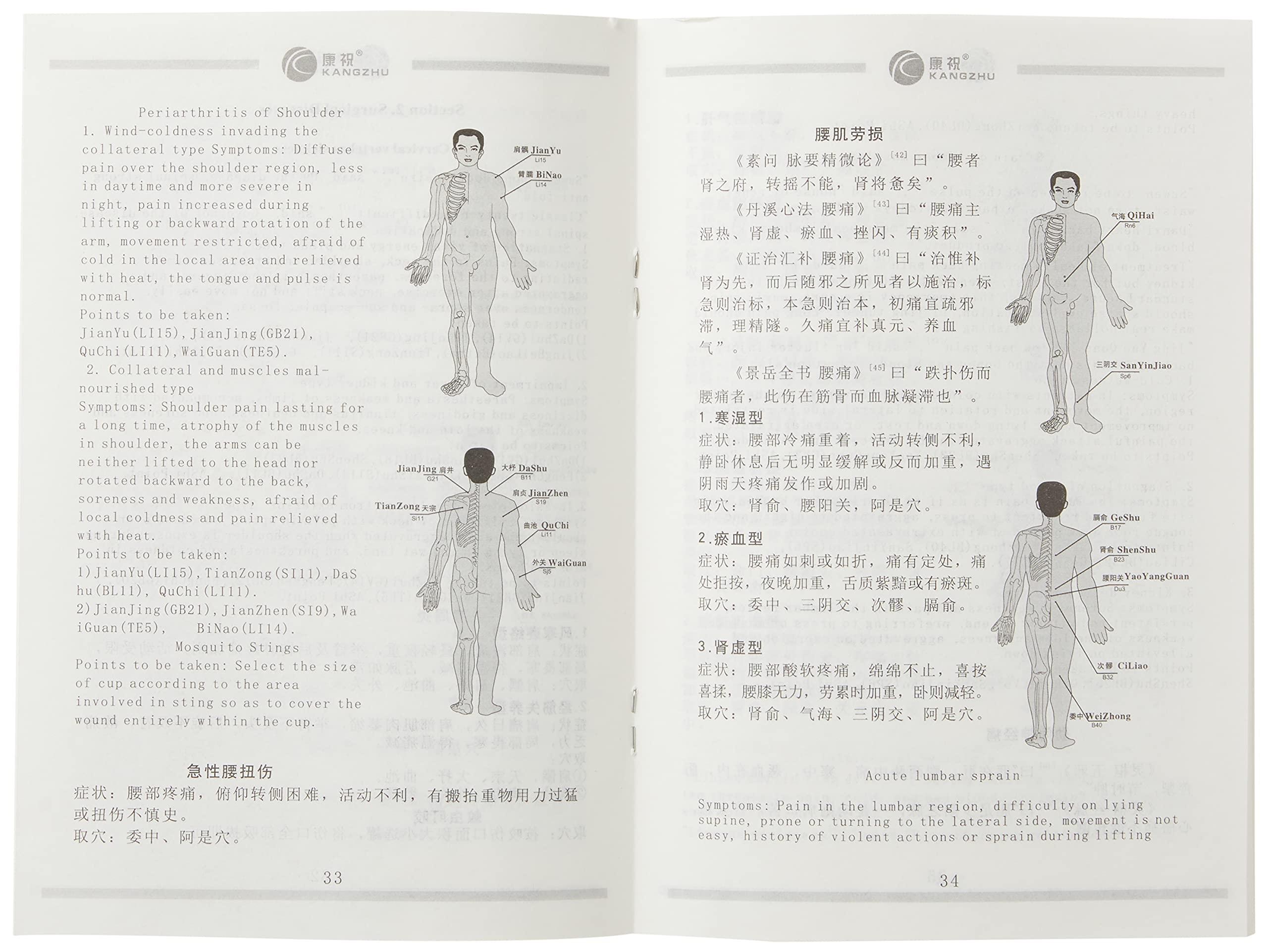 Kangzhu Kangzhu 6 Cup Biomagnetic Chinese Cupping Therapy Set