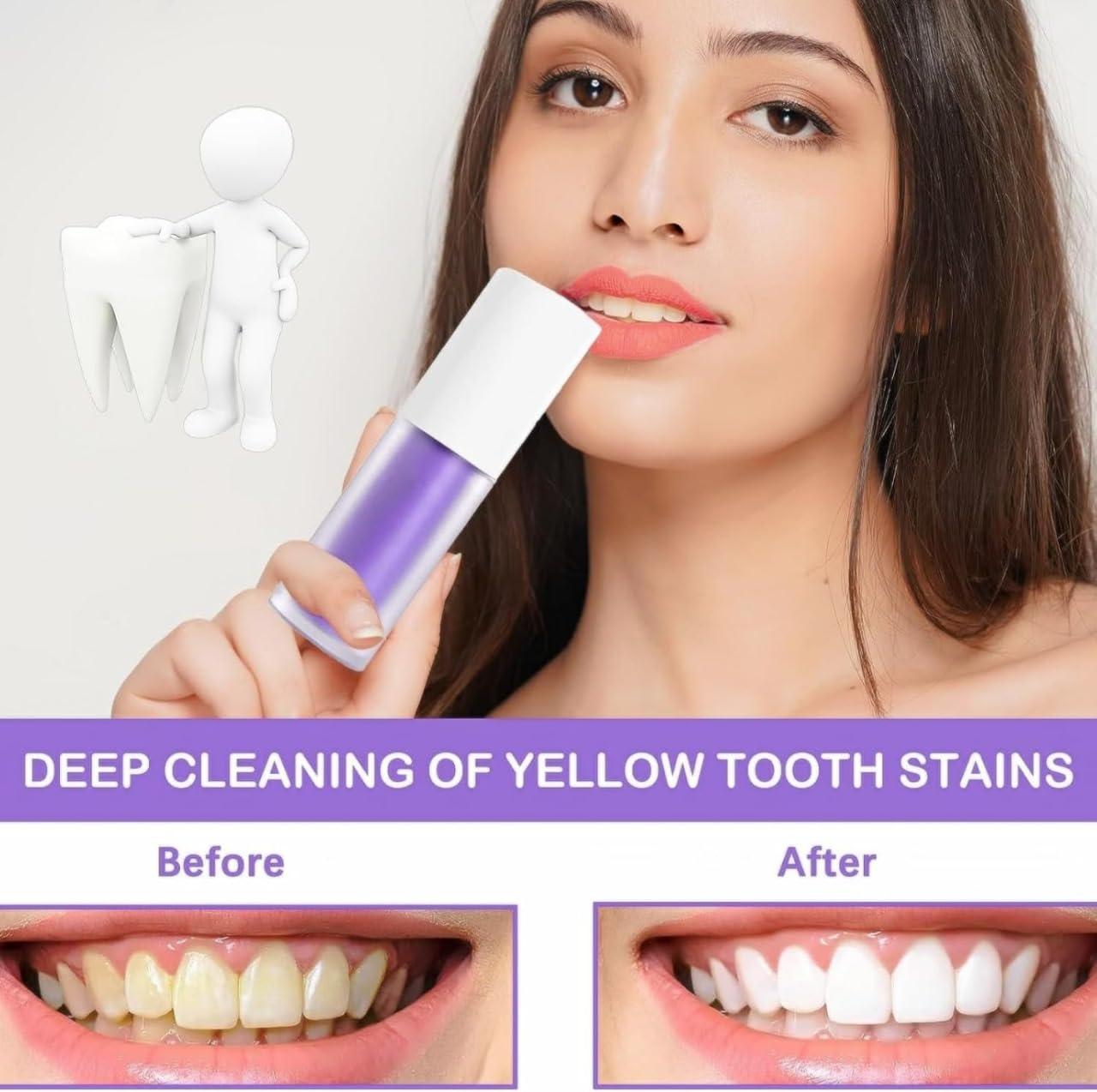 NavaFresh Basics ELOEE | Purple Toothpaste Serum Smile for Teeth Whitening V34 - A Yellow-Better Brush Against Bad Breath and Brightening with Col-gate Eelhoe. Introducing Color-Correcting Irrirani Kit