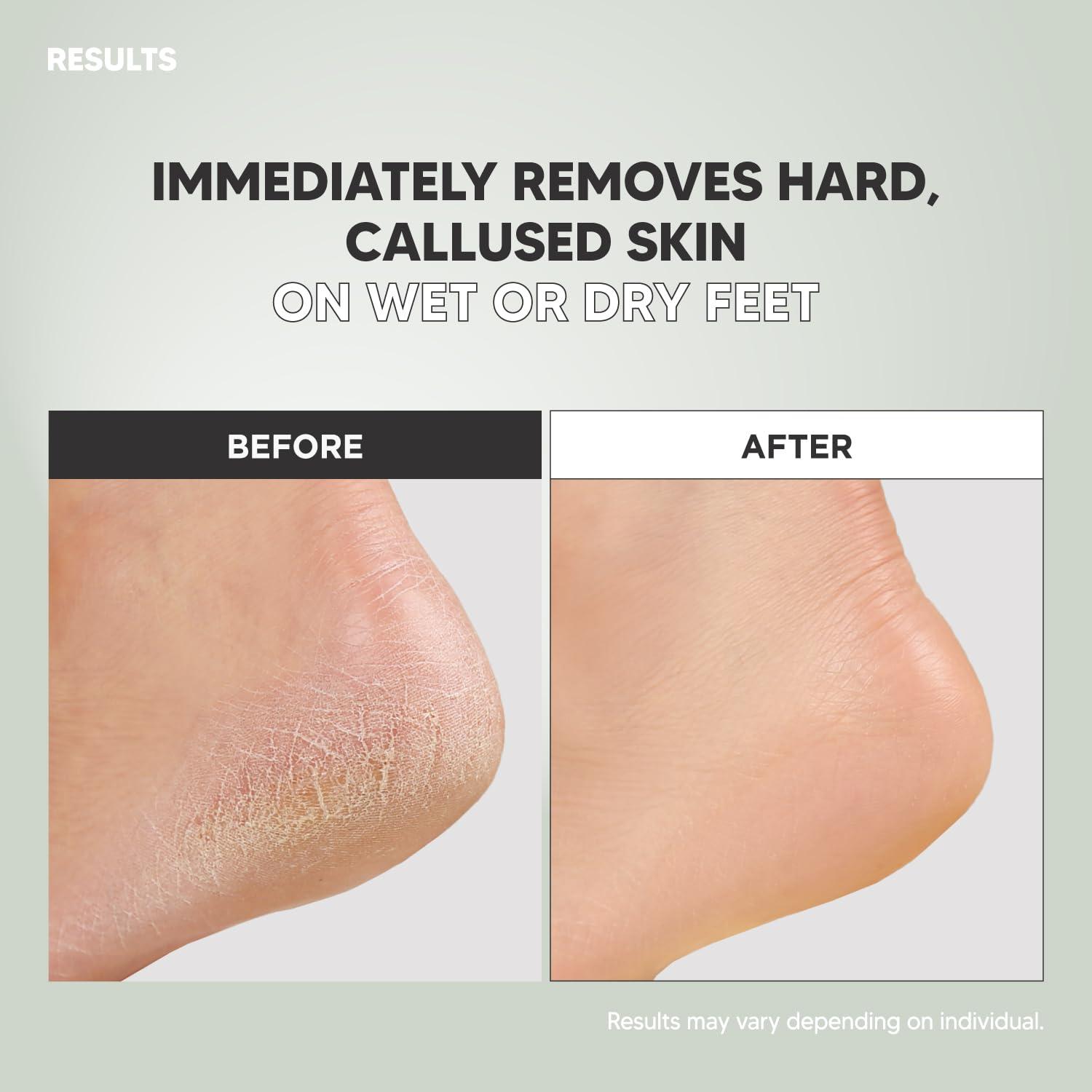 F3 systems F3 Systems S-Line Emery Foot file, Double-Sided Pedicure Tool, Effective for Cracked Heel, Ergonomic Design for Easy Grip